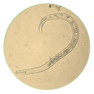 ingrandimento al microscopio di nematodi